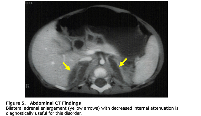 Figure 5. Abdominal CT Findings
          